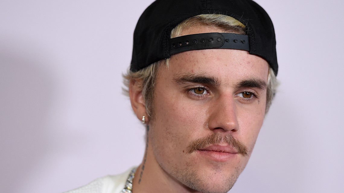 Wajah Justin Bieber lumpuh sebagian setelah virus