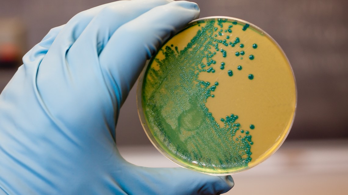 Wabah Listeria mungkin terkait dengan Florida, CDC menyelidiki
