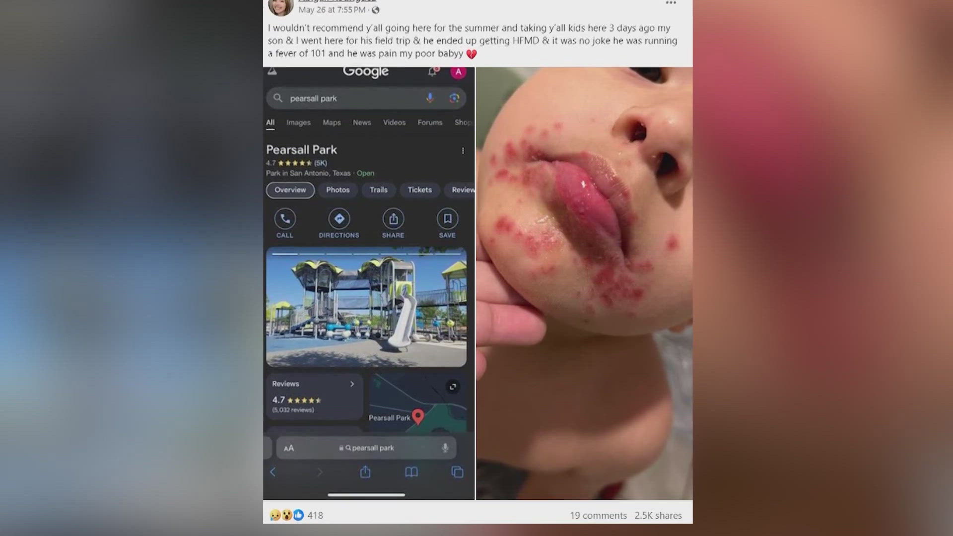 After a local mom's Facebook post about her son contracting the virus went viral, experts share tips on how to keep your children safe.
