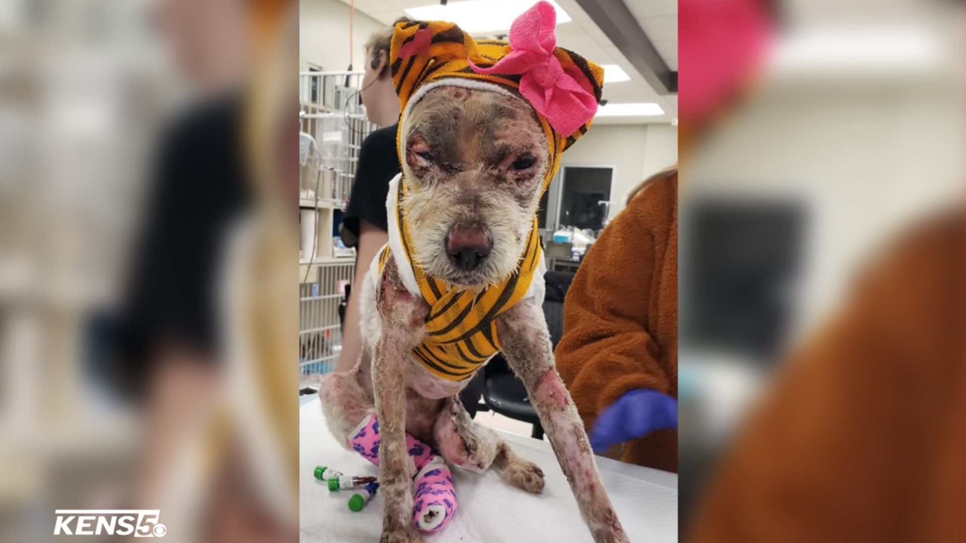 She was named Phoenix by her rescuers who hope that like a Phoenix, she too will rise from the ashes as she recovers from surgeries and treatments.