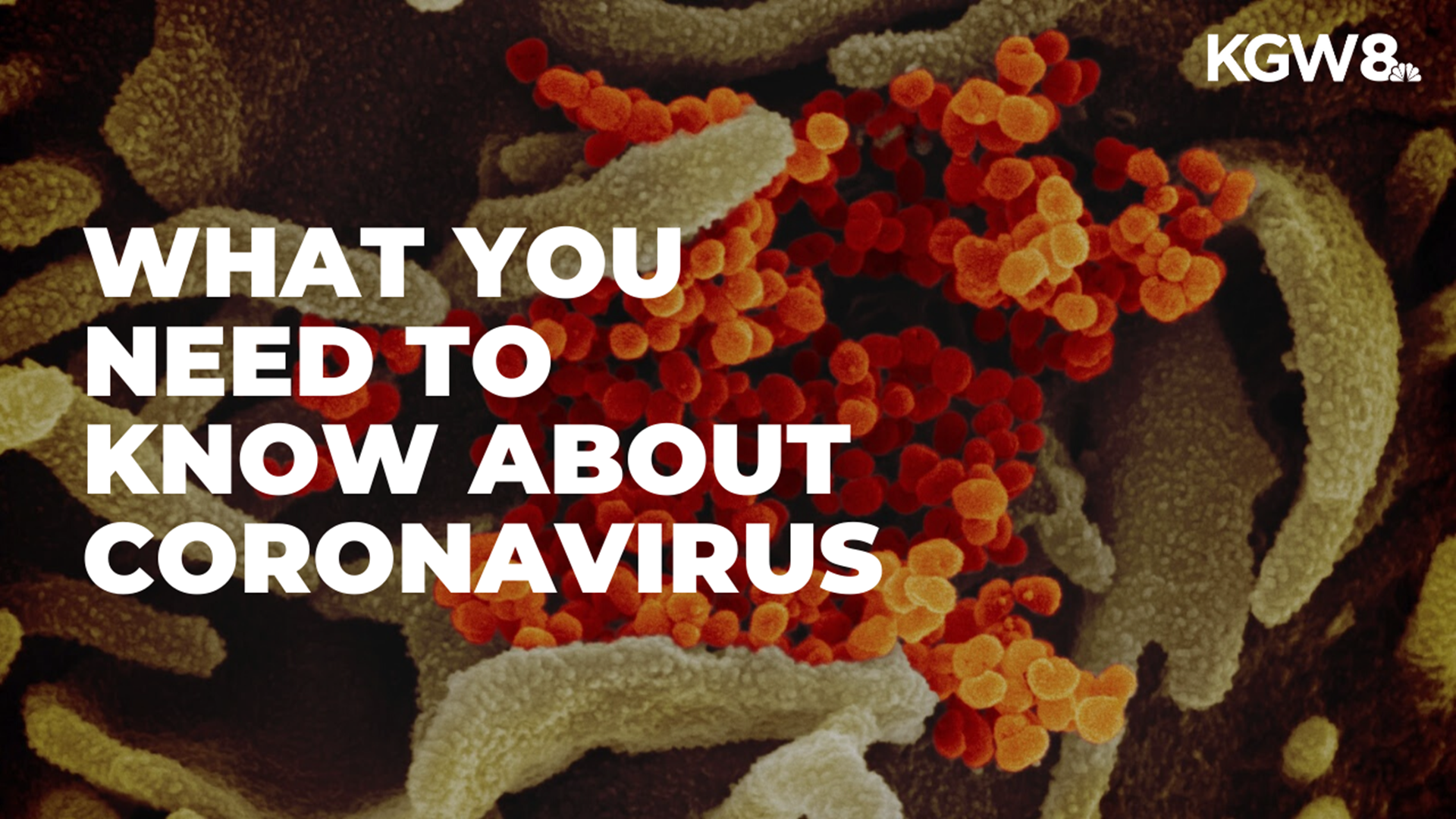 Here are frequently asked questions and answers about COVID-19 or the coronavirus.