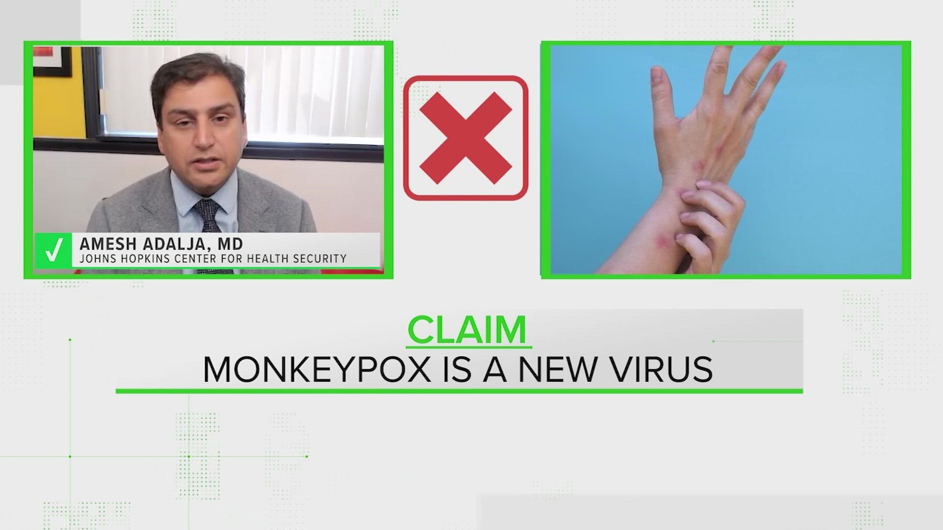 VERIFY: The Monkeypox Did Not Come From Monkeys | Khou.com