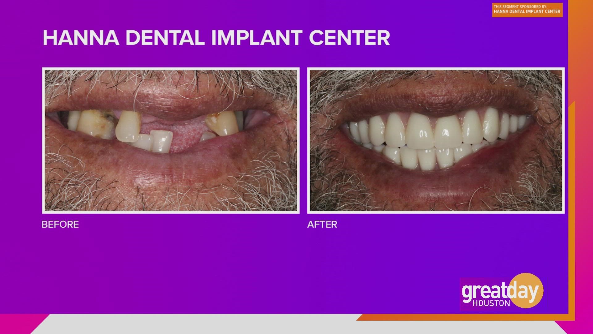 Dr. Raouf Hanna of Hanna Dental Implant Center offers full mouth makeovers