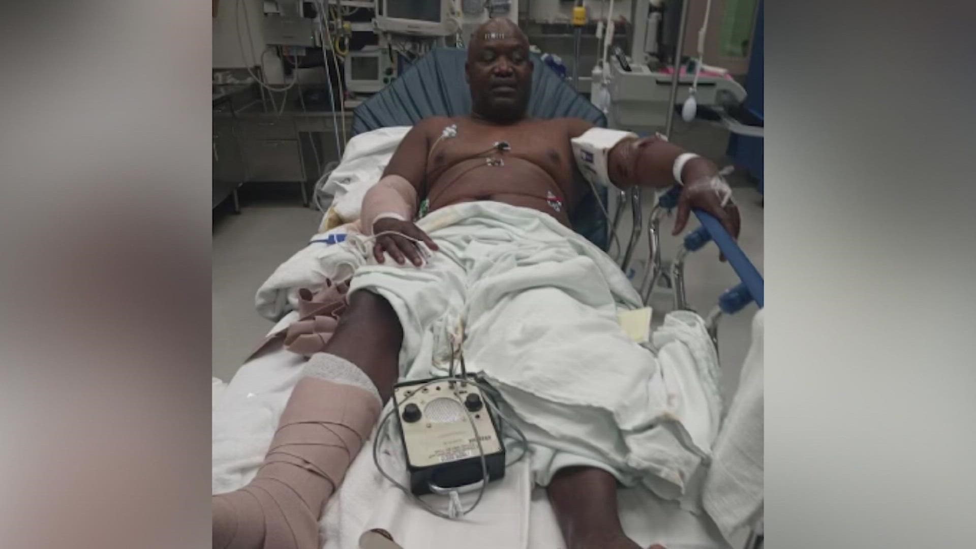 A Dallas man is healing after his vacation to Galveston ended when he was attacked by two dogs. The incident happened outside his home on the island.
