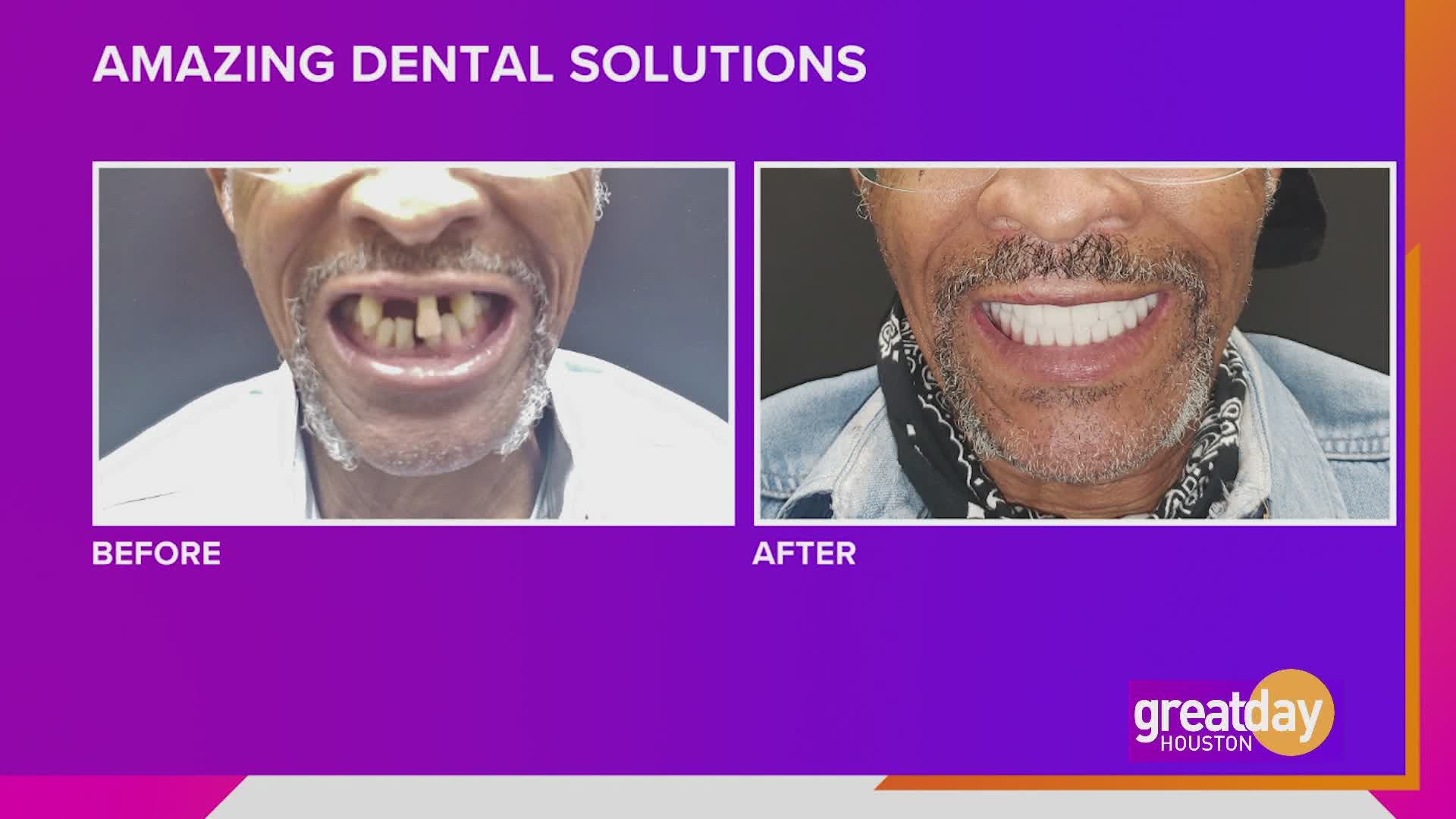 Dr. James Amaning helps restore your smile, self-esteem and life