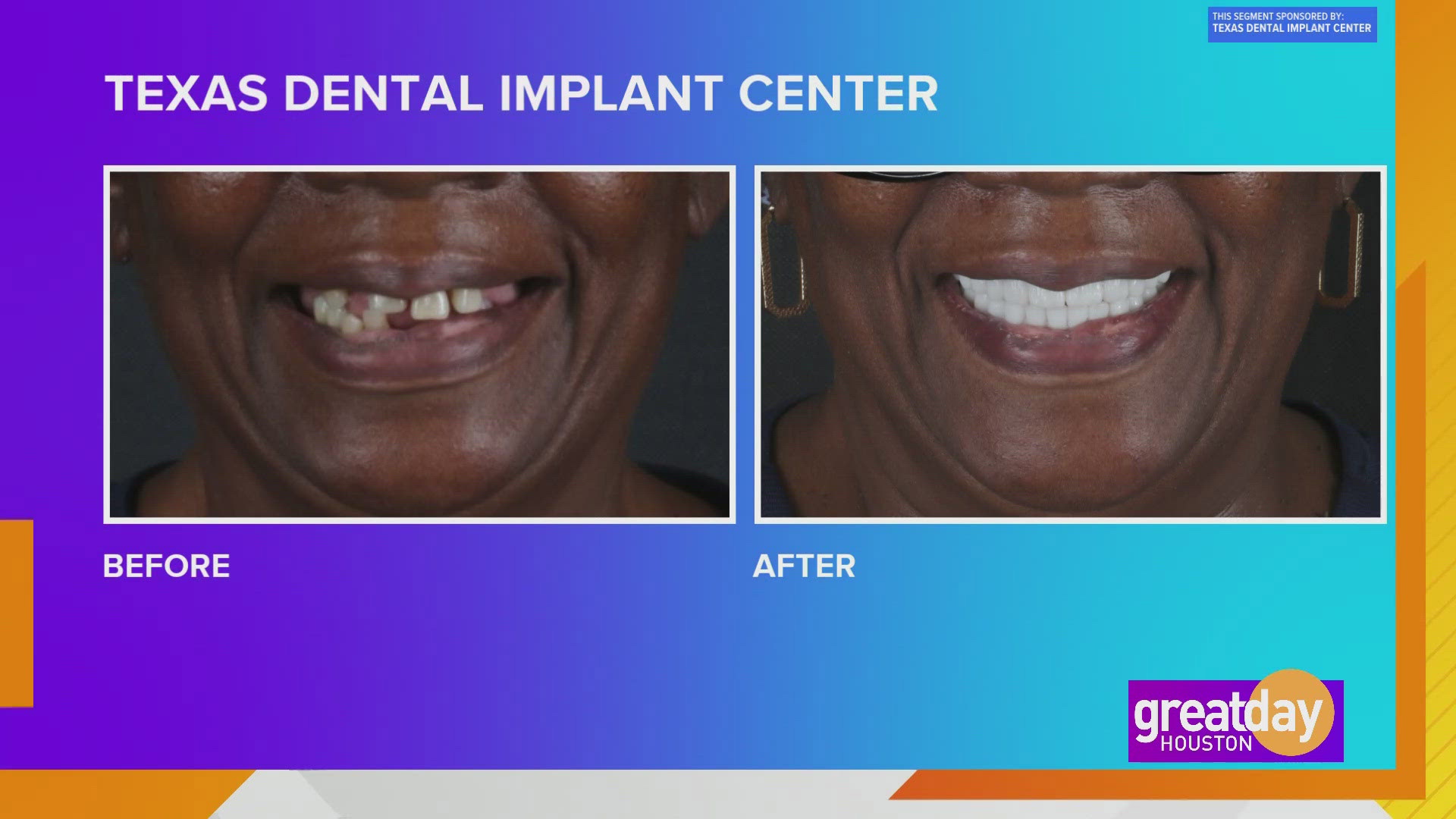 Let the Texas Dental Implant Center can give you the smile and confidence of your dreams.