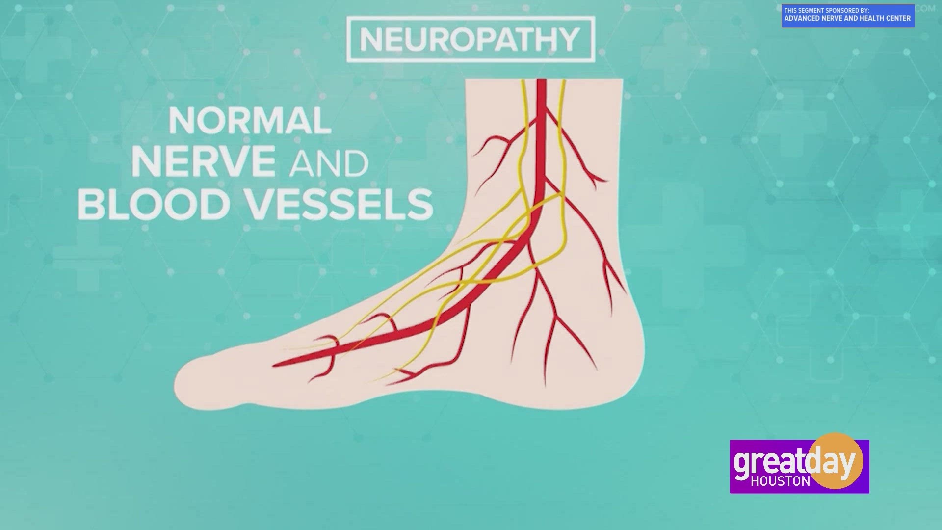 Stop the debilitating symptoms of neuropathy. Make a change today with help from Advanced Nerve and Health Center.