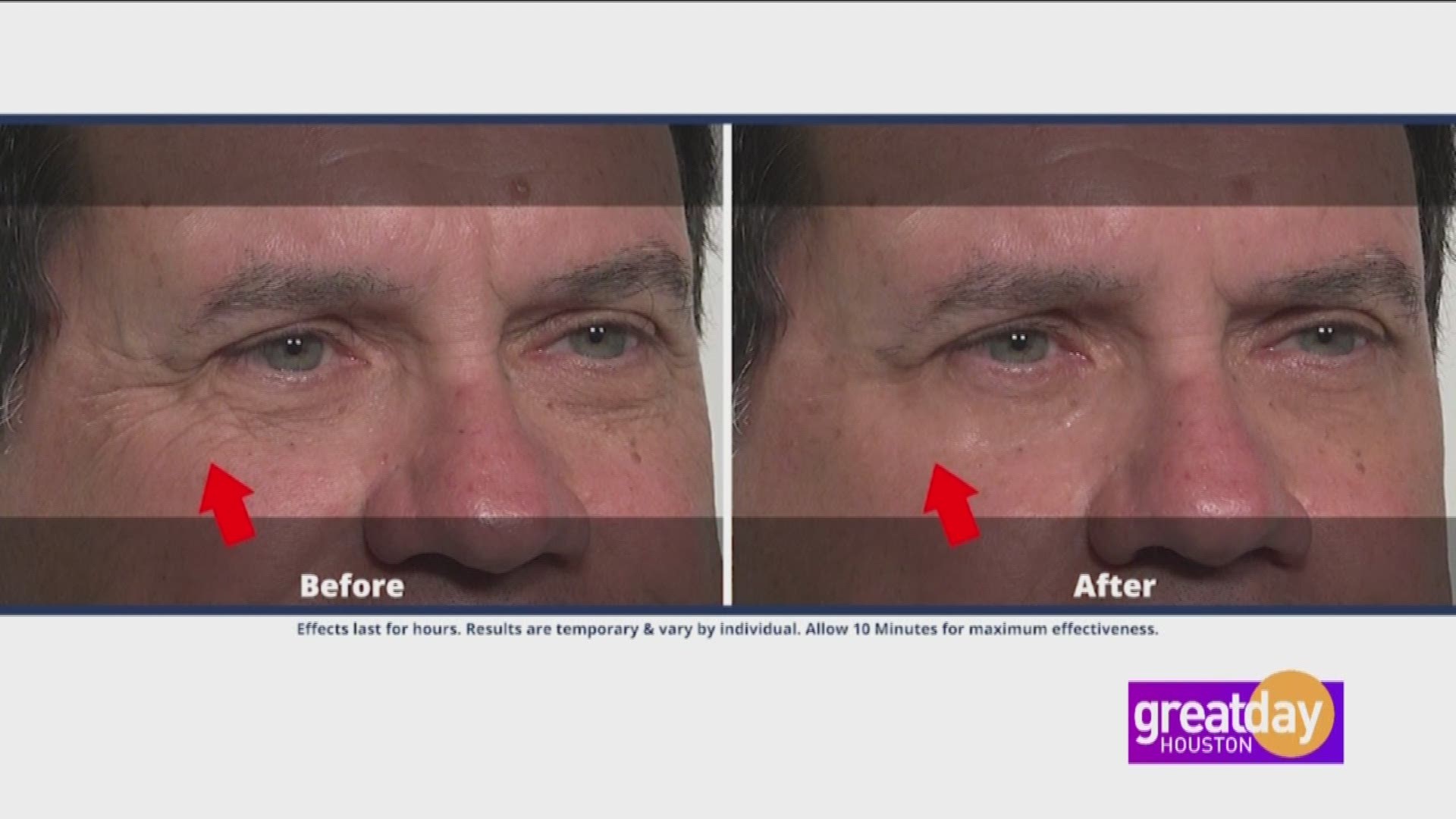 Plexaderm makes you look younger in just minutes.  Melinda McKinsey showed Deborah Duncan its incredible results.