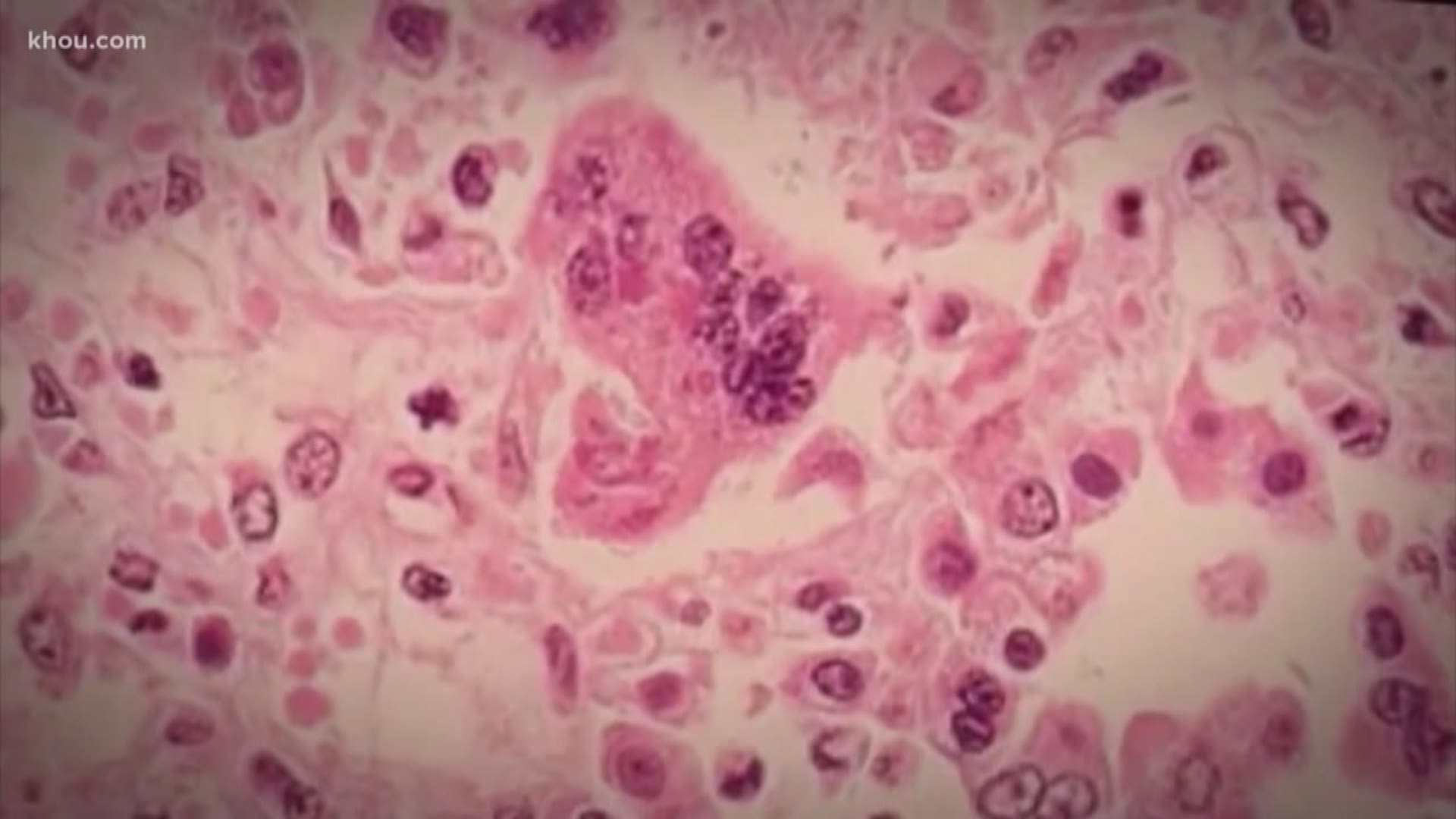 The CDC is warning that if measles transmissions continue through September, the World Health Organization could strip the U.S. of its measles elimination status.