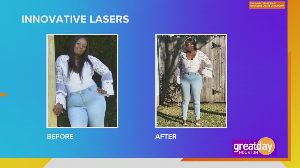 Laser inovatif Houston dapat membantu Anda menurunkan berat badan dan mendapatkan kepercayaan diri