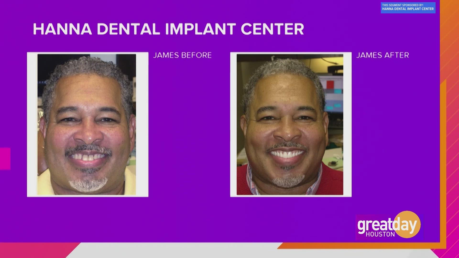 Michael was all smiles after visiting Hanna Dental Implant Center