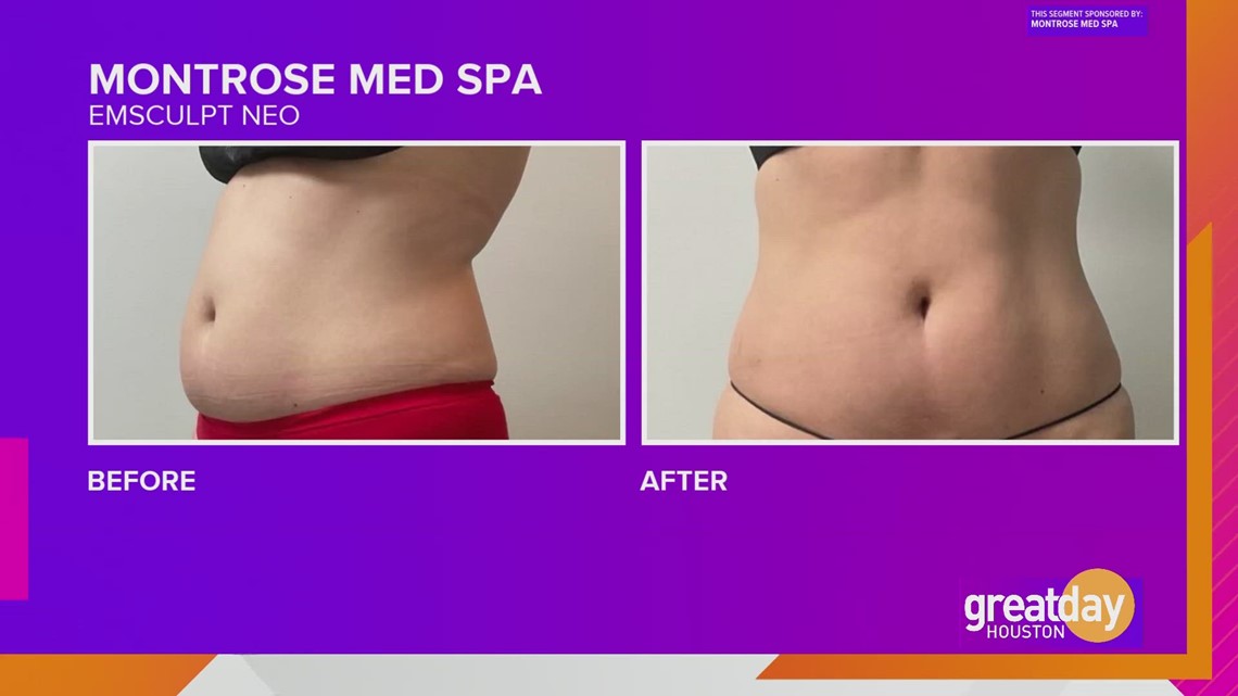 Sponsored How Montrose Med Spa makes it easy to transform your face