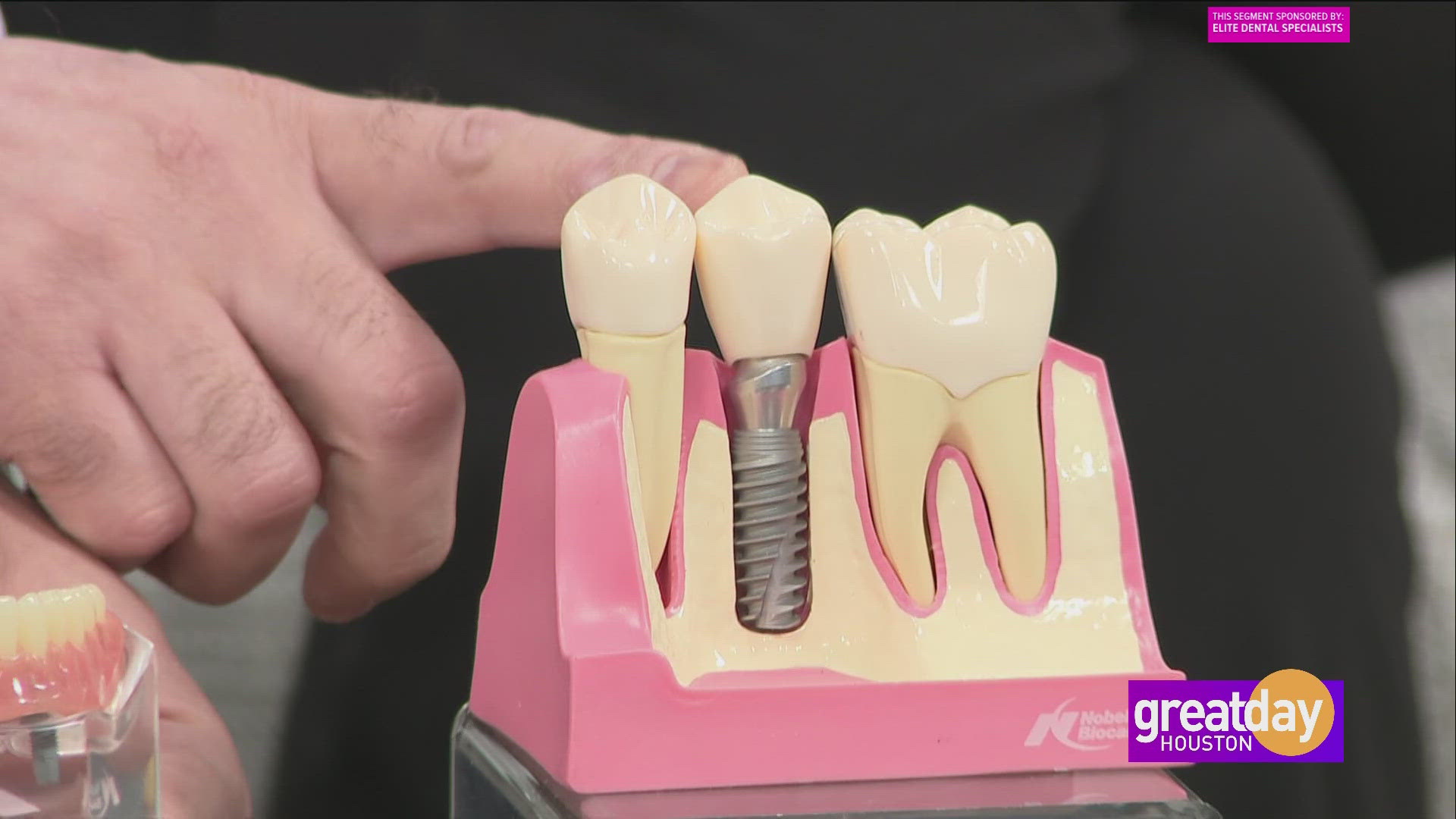 Dr. Ali Obeidi and his client, Schan Johnson, share the power of full-mouth restorations with dental implants.