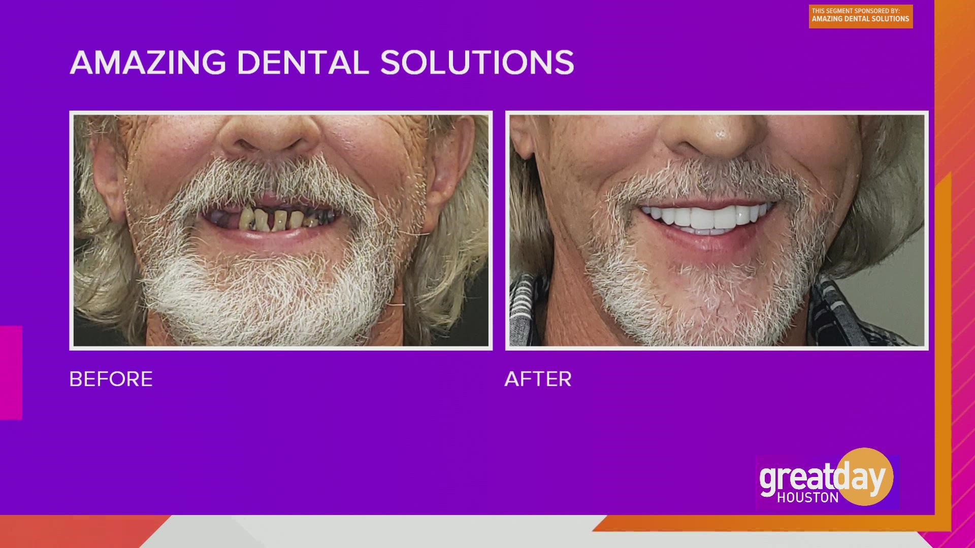 Dr. James Amaning can restore your smile with dental implants