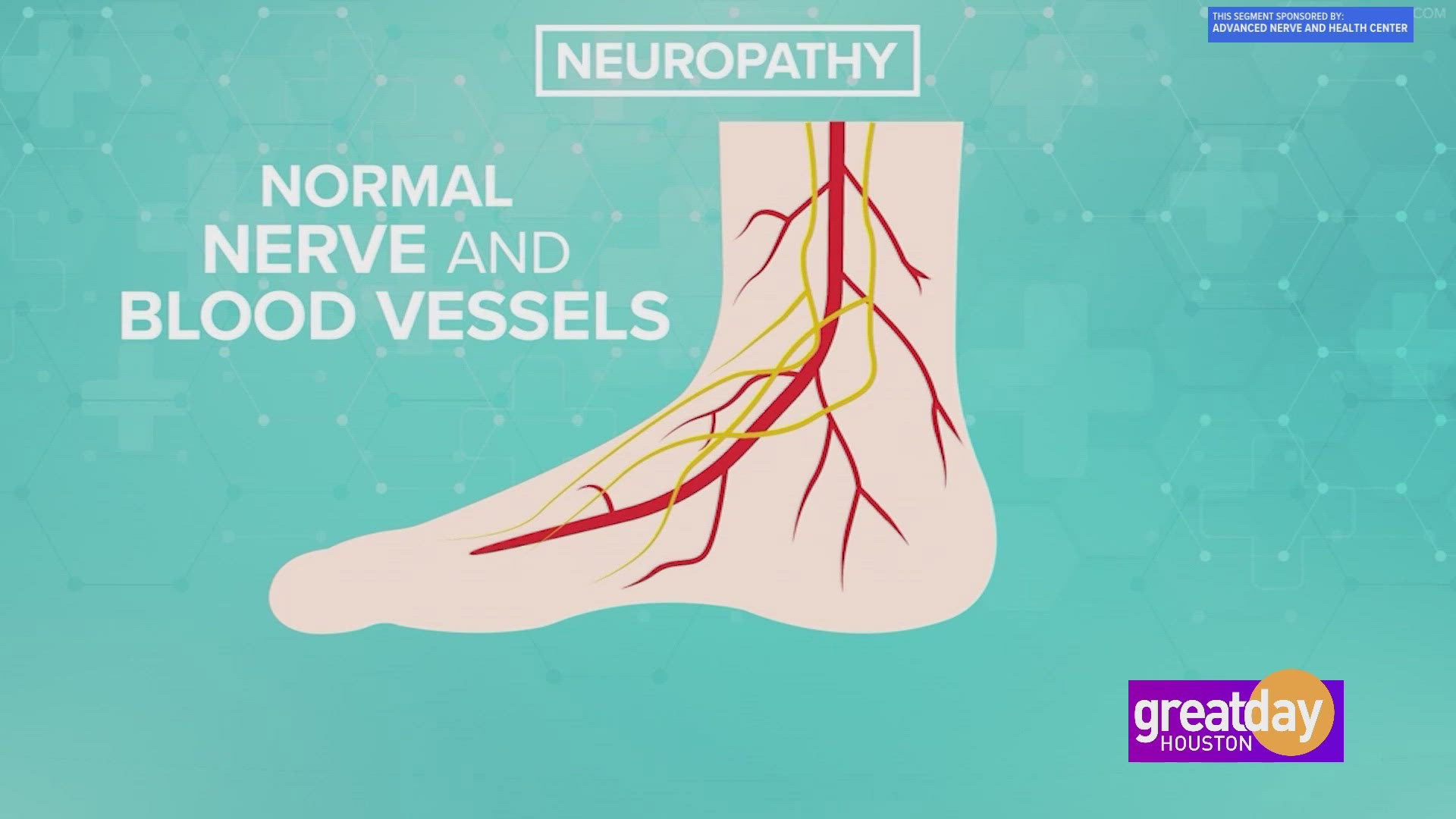 Stop the debilitating symptoms of neuropathy. Make a change today with help from Advanced Nerve and Health Center.