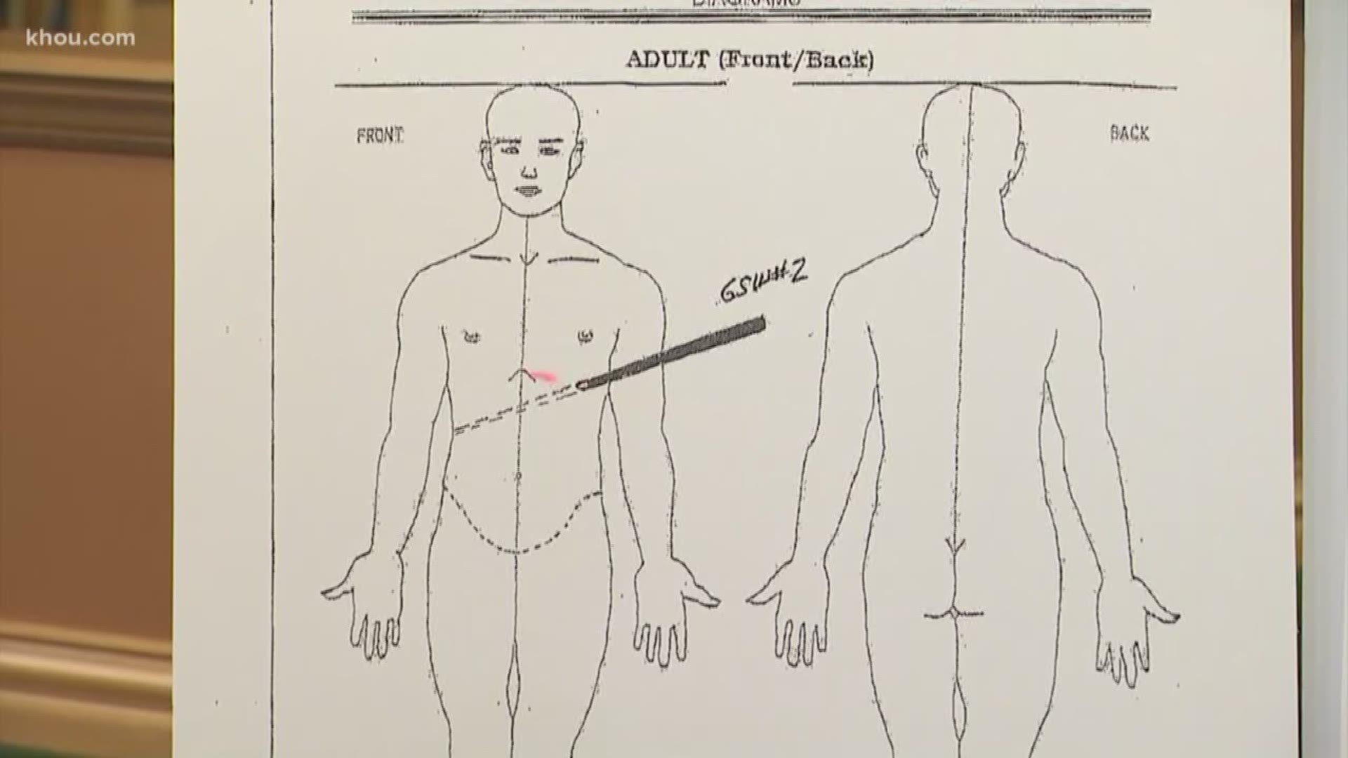 Women autopsy 