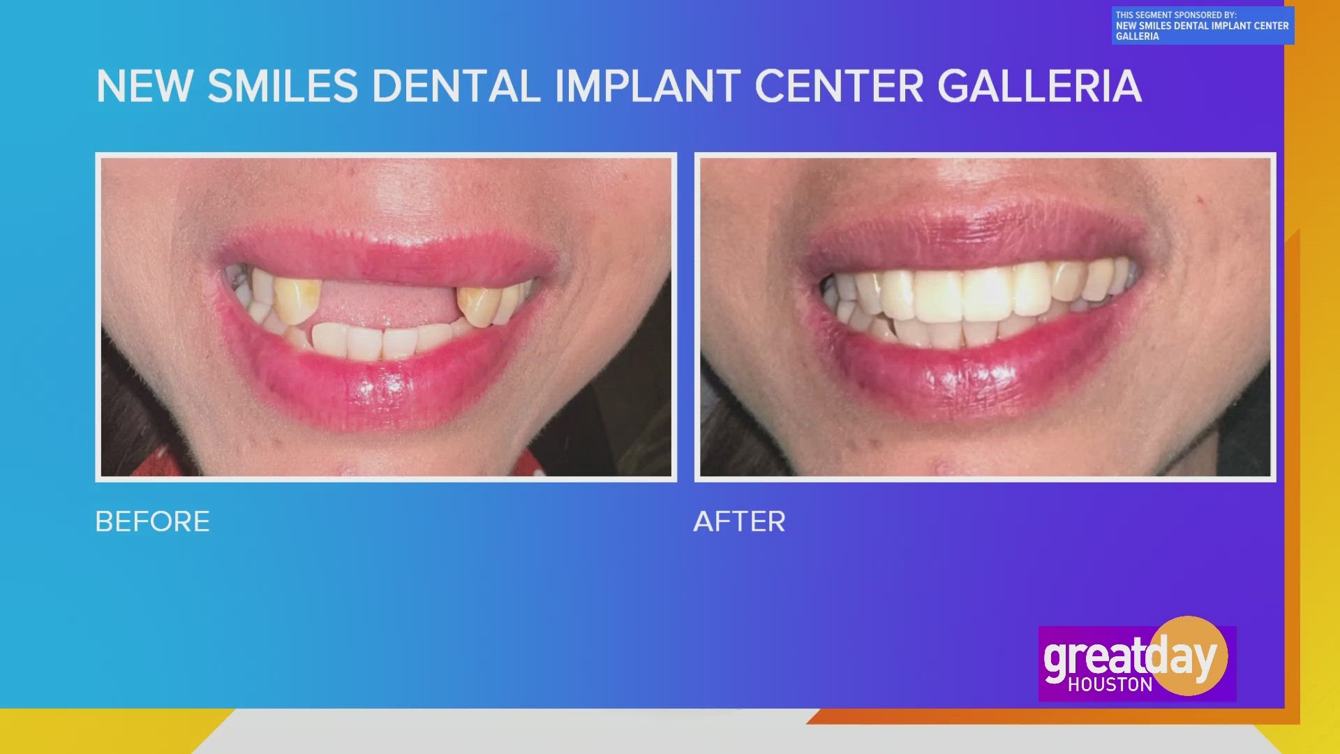 New Smiles Dental Implant Center Galleria specializes in completing a person's smile, especially for those who are missing teeth.