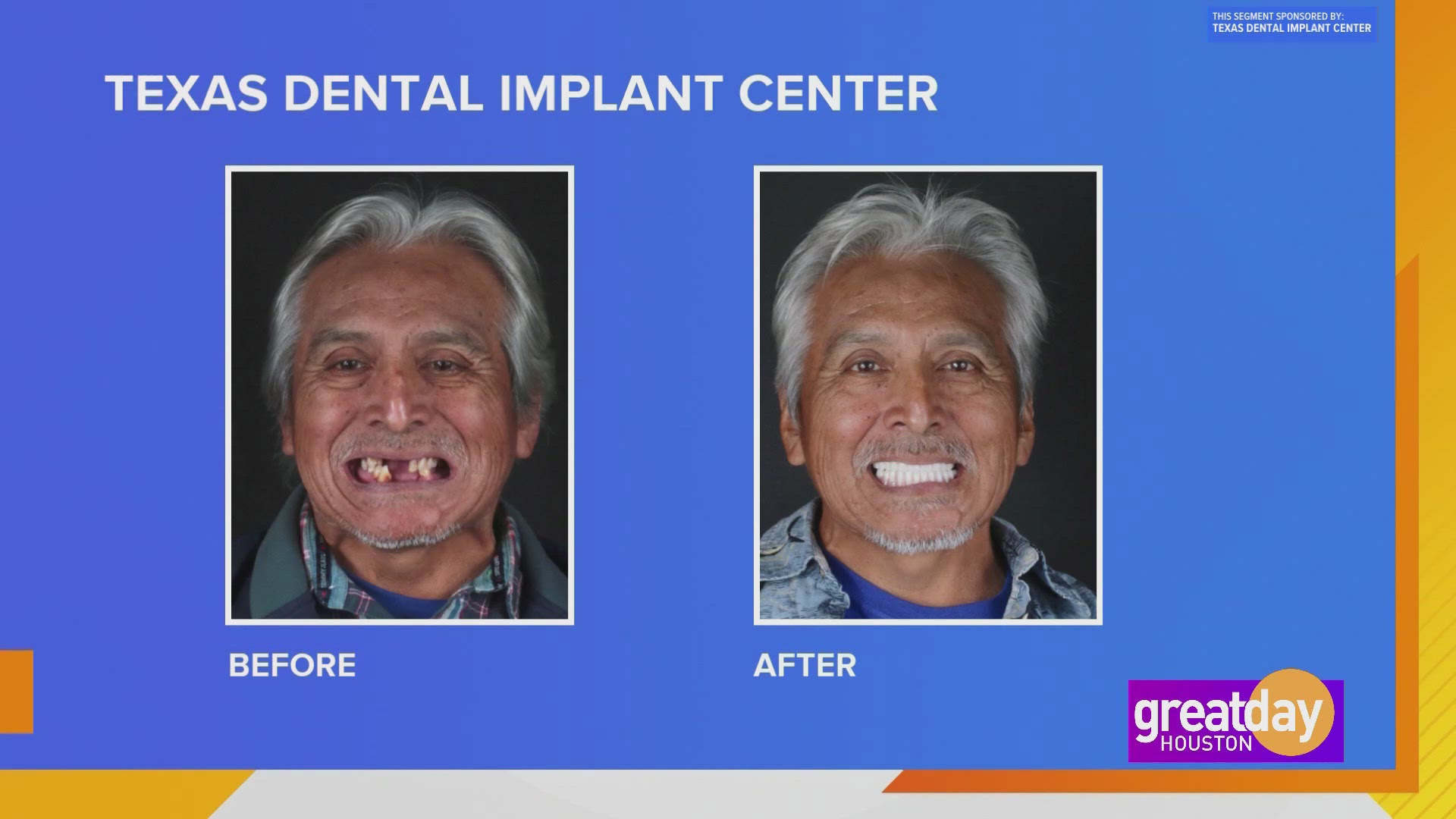 Sponsored Get the smile you've always wanted with help from Texas