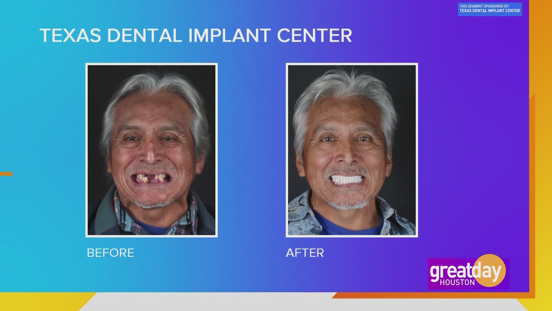 Texas Dental Implant Center can give you the smile of your dreams, no matter what your current situation is.