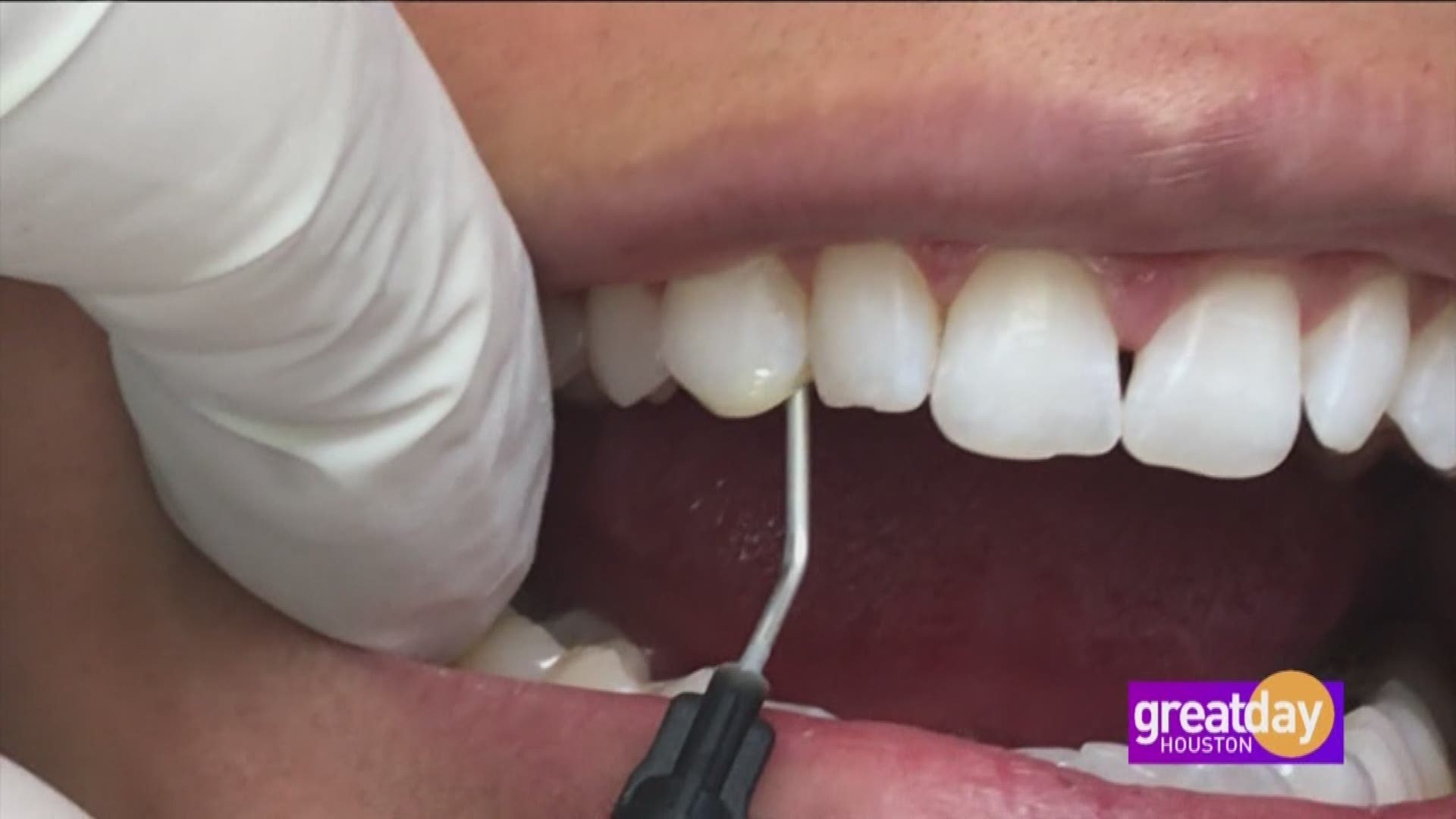 It's easy to upgrade your smile with Lumineers. Dr. Terri Alani shows us how.