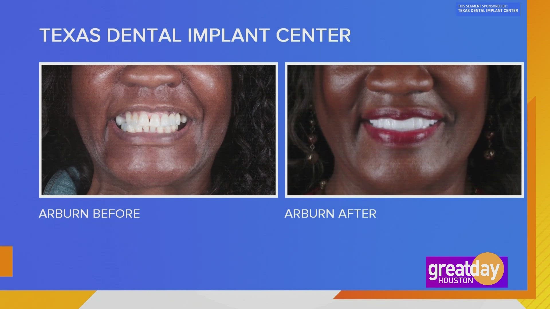 Sponsored Regain your smile, regain your life with help from Texas