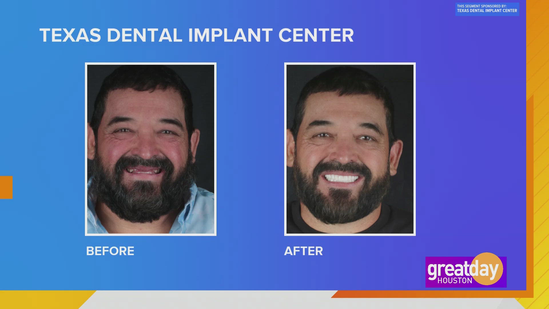 Let the Texas Dental Implant Center can give you the smile and confidence of your dreams.