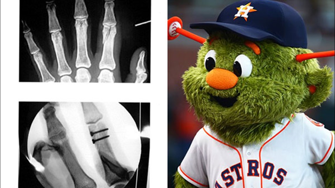 Fan sues Astros, claims Orbit's T-shirt cannon shattered her finger