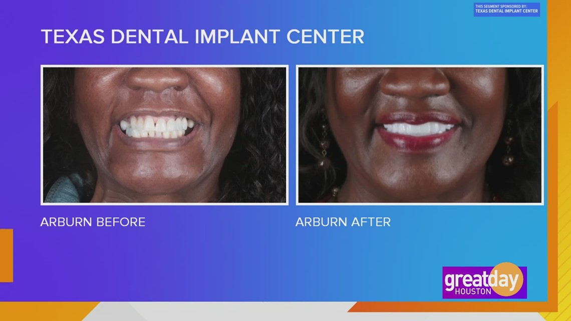 Dapatkan kembali senyum Anda, dapatkan kembali hidup Anda dengan bantuan dari Texas Dental Implant Center