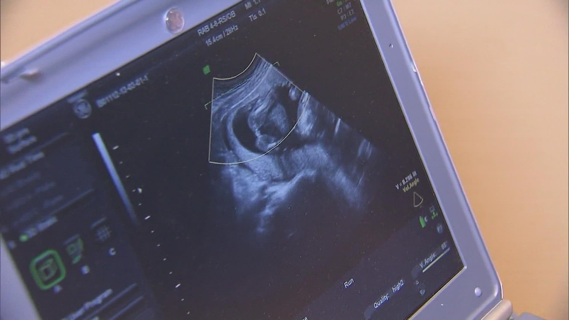 A federal appeals court is now allowing Texas to once again ban most abortions in the state.