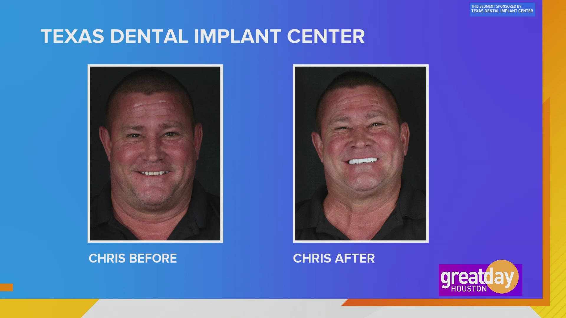 Let the Texas Dental Implant Center can give you the smile and confidence of your dreams.