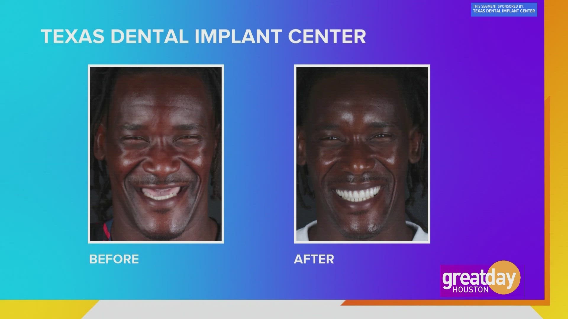 Let the Texas Dental Implant Center can give you the smile and confidence of your dreams.