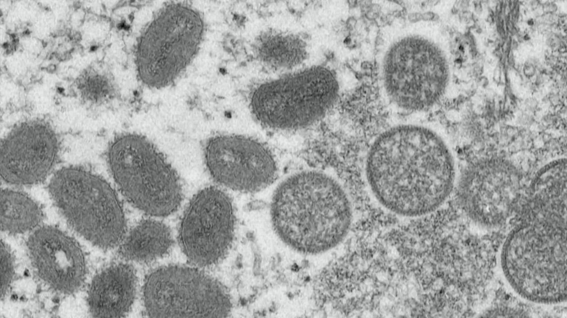 CDC warns of possible mpox resurgence this summer