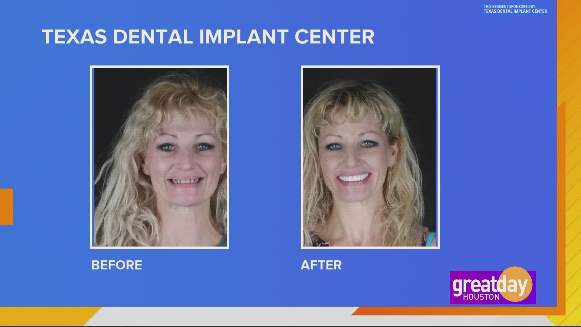 Many people experience missing or broken teeth as they age. A trip to Texas Dental Implant Center can help transform your smile for good!