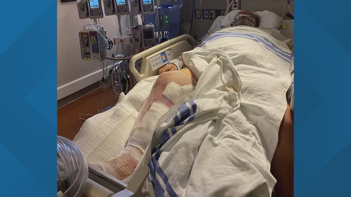 Oklahoma man nearly loses leg after contracting flesh-eating bacteria during family trip to Crystal Beach - Vimarsana News