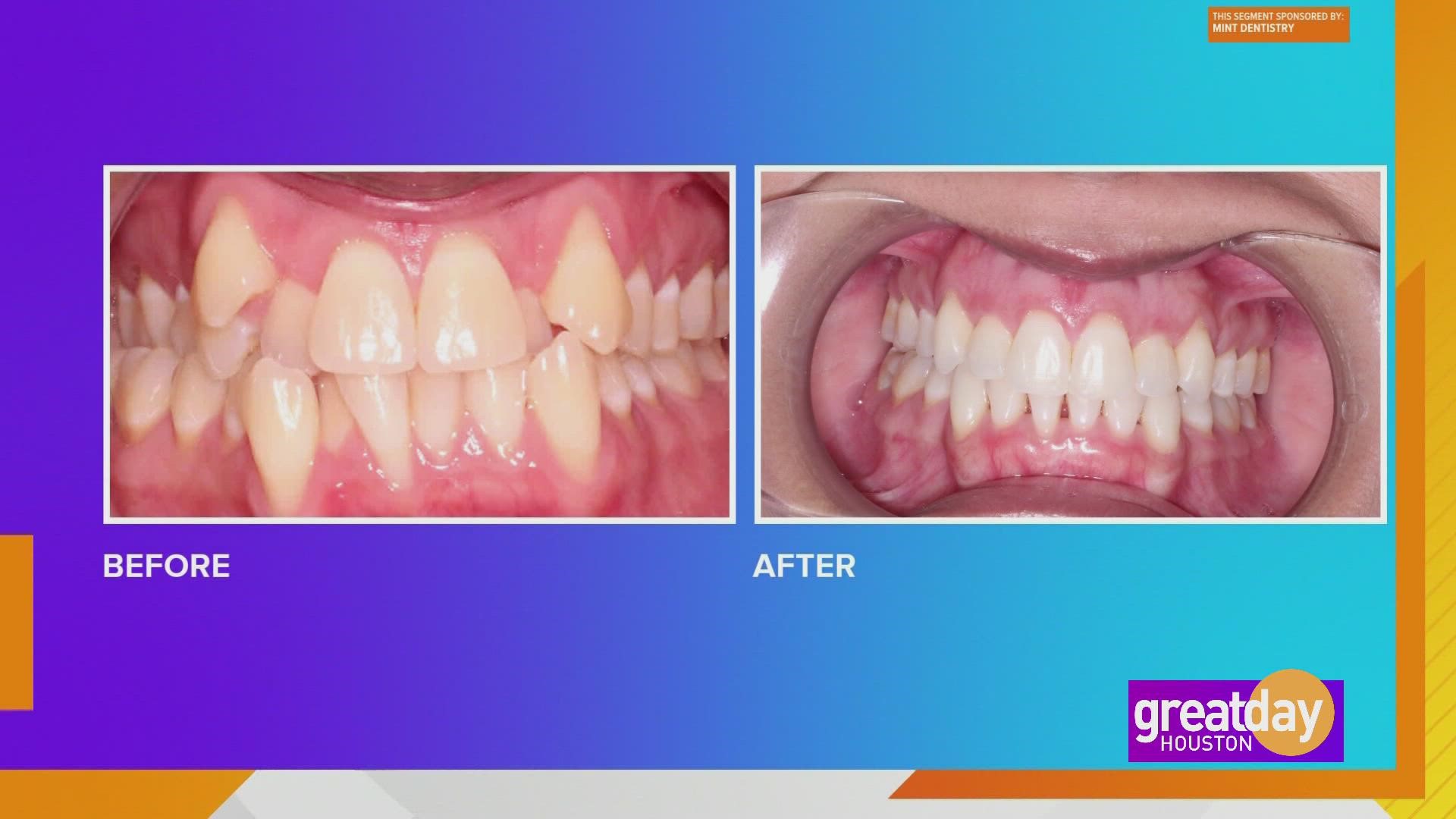 Enhance & embrace your smile with MINT Dentistry & Orthodontics