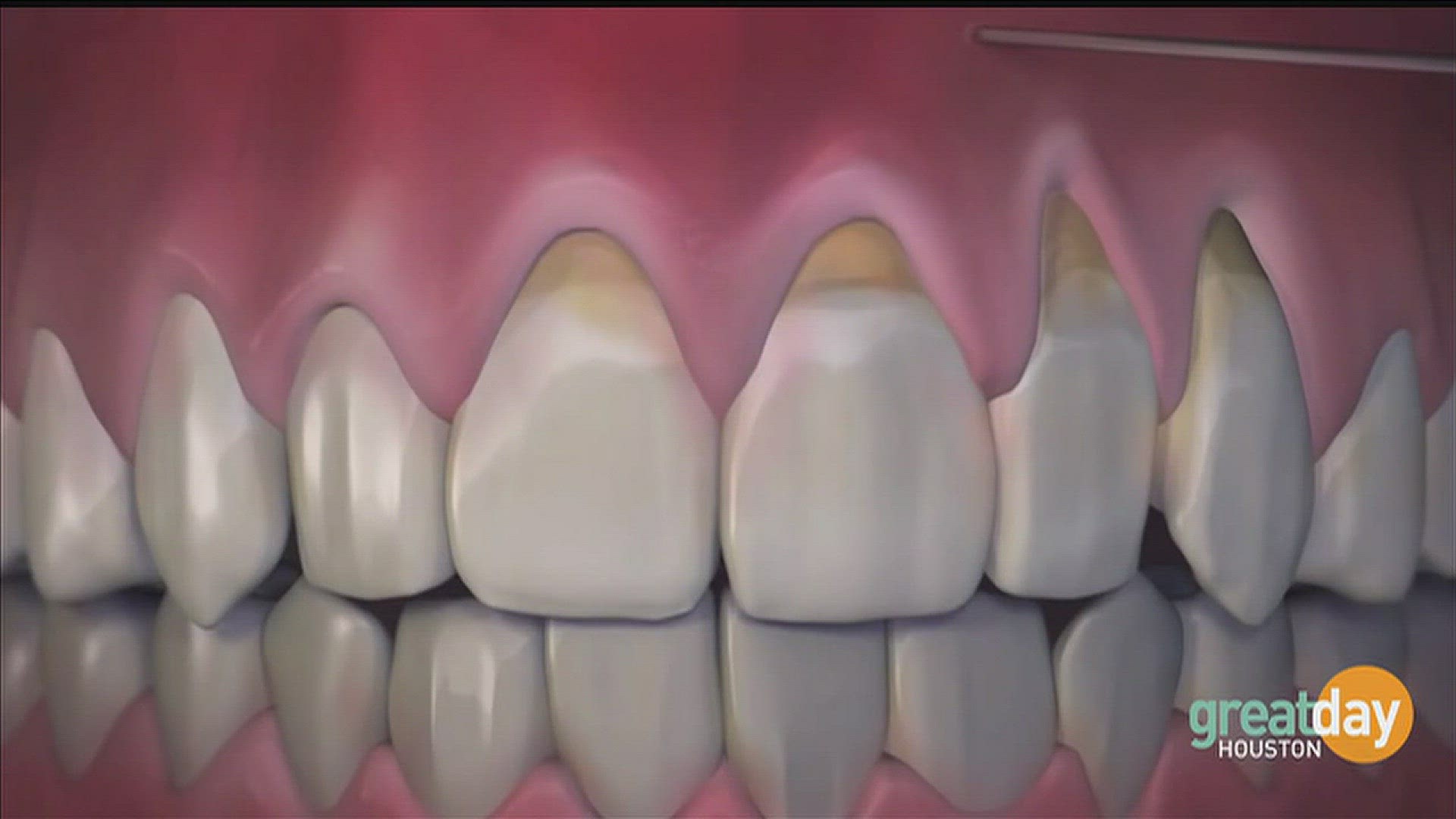 Medical Center Dental Group | khou.com