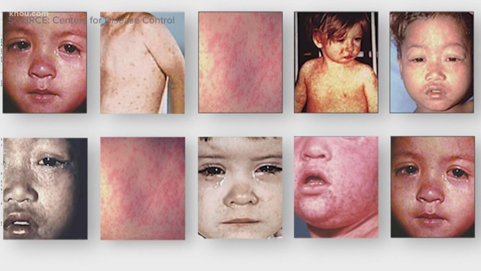 The measles was eliminated in the U.S. in 2000, that's according to the CDC. So how did it resurface? KHOU 11 Reporter Melissa Correa breaks down the history of the highly-contagious virus.