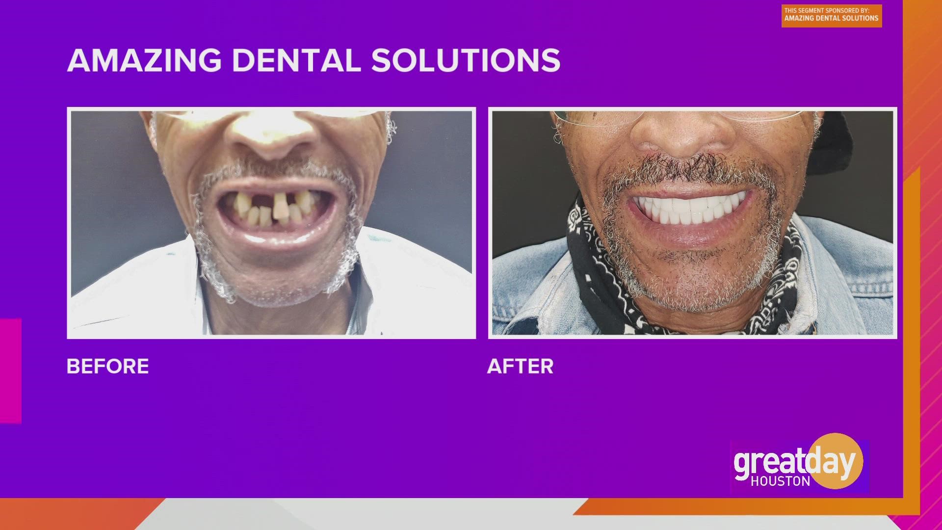 From missing teeth to having the brightest smile in the room, Dr. Amaning, owner of Amazing Dental Solutions, shares how his dental magic works!