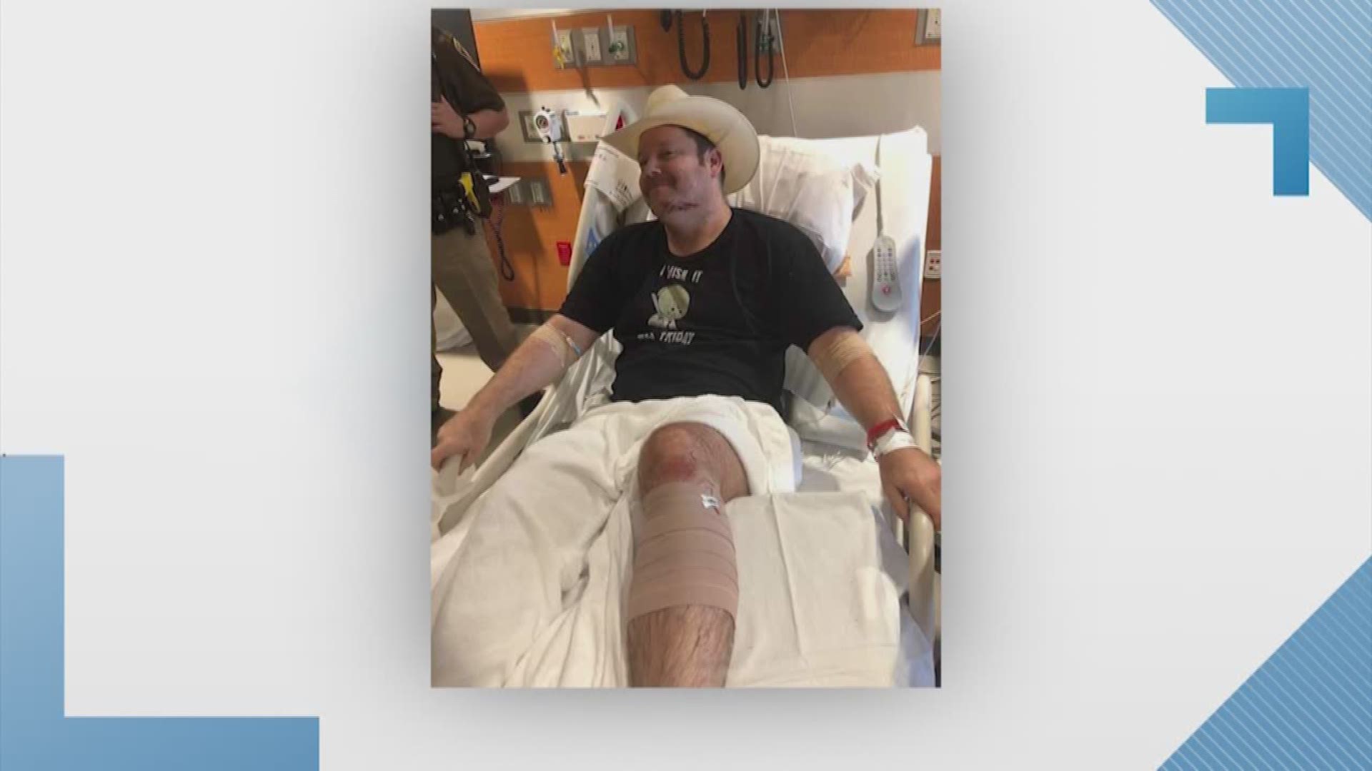 The Fort Bend County Sheriff's Office deputy who was wounded after responding to a domestic dispute earlier this week is expected to make a full recovery. Deputy J. Bulman, wearing a heavy bandage on his left calf and a cowboy hat, flashed a grin and tilt