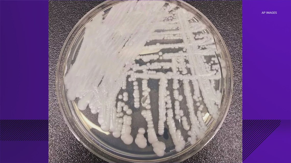 CDC warns of 'alarming' recent rise of deadly fungus