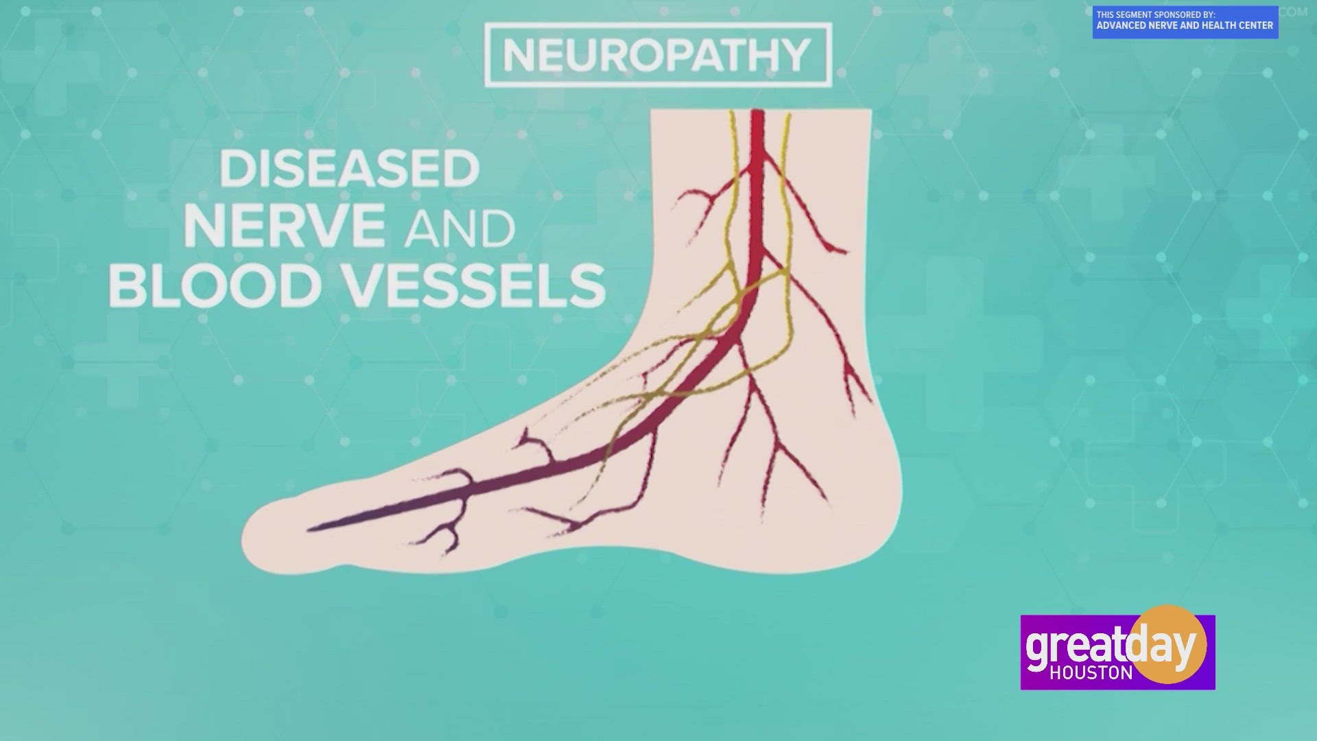 Stop the debilitating symptoms of neuropathy. Make a change today with help from Advanced Nerve and Health Center.