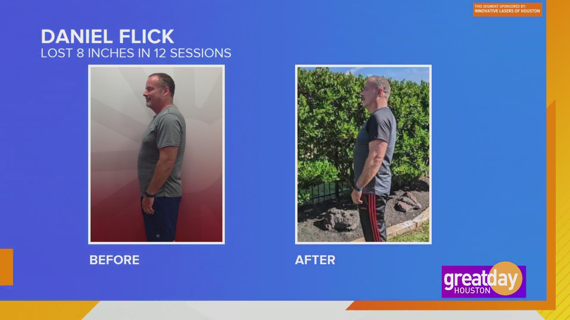 How a red light laser melted away fat for one Houstonian and in turn he was able to work out, gain confidence and even tie his shoe without holding his breath.