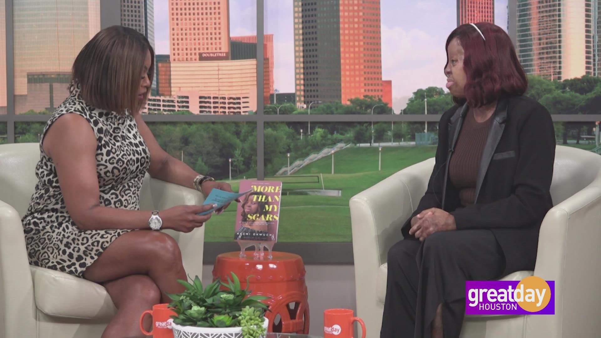 Singer and motivational speaker Kechi Okwuchi discusses her new book, "More Than My Scars"