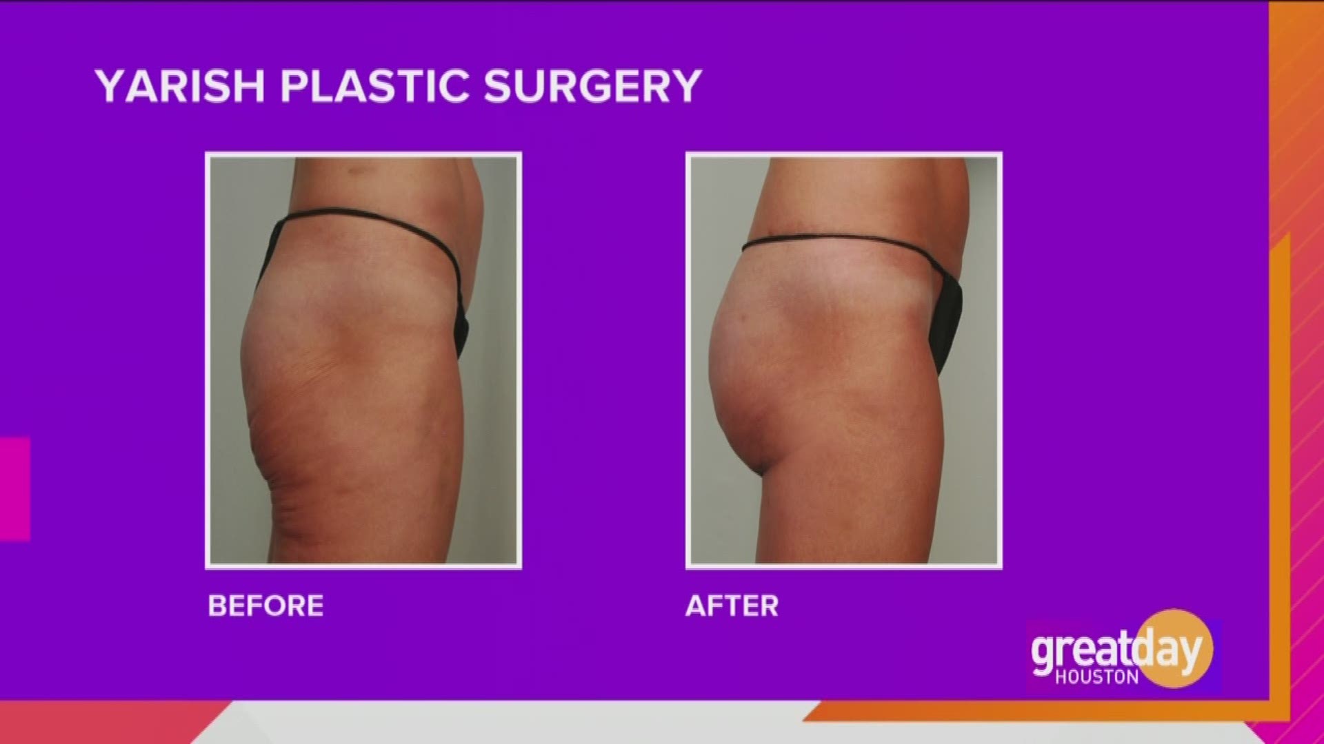 Improve your look with the help of Yarish Plastic Surgery.