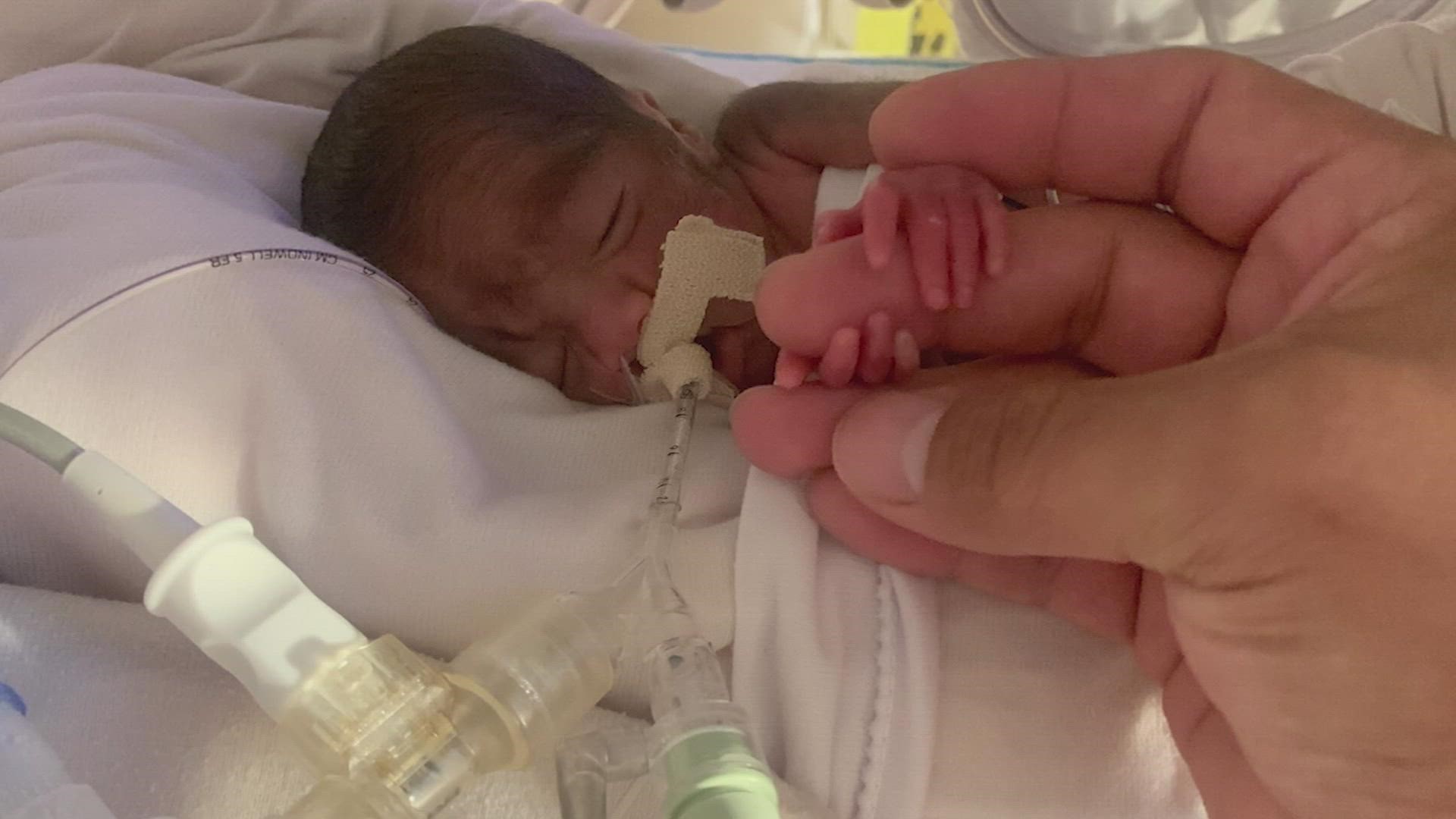 Tiny Baby Born At 22 Weeks Going Home For The Holidays Khou