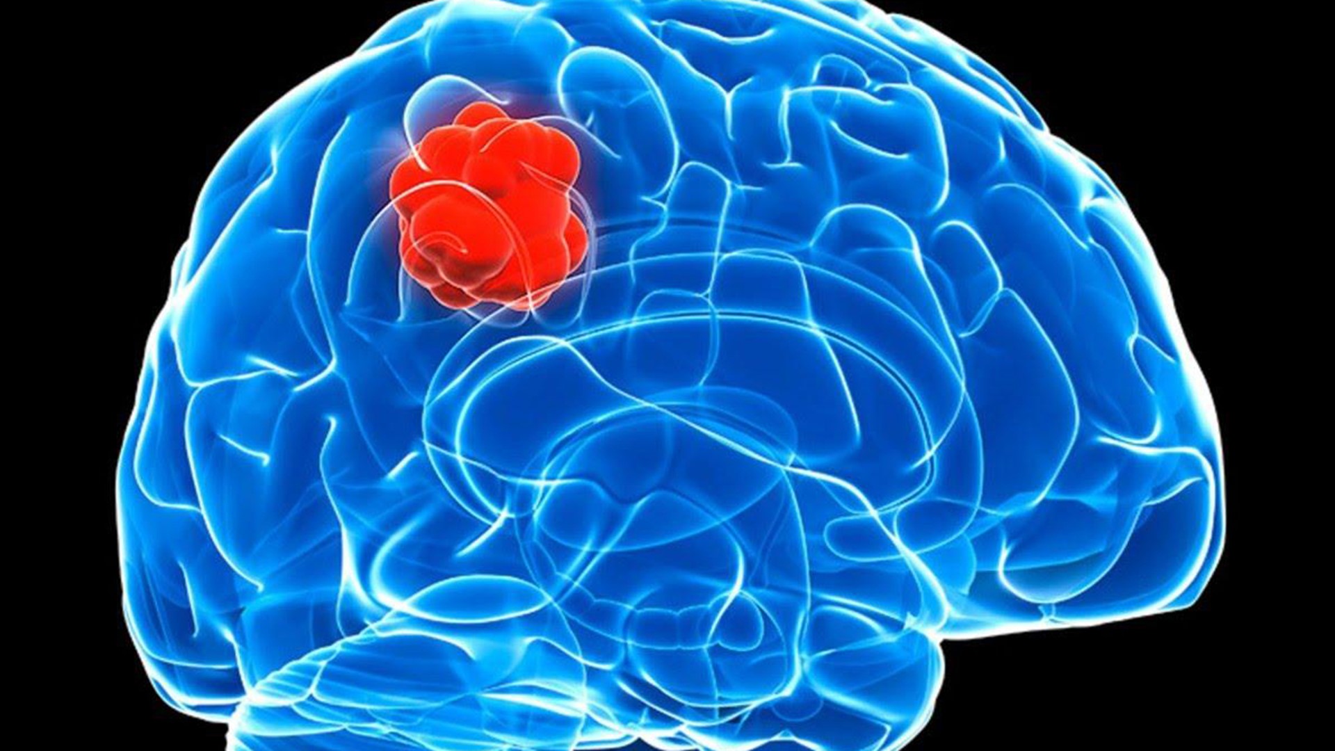 Dog dewormer, pinworm medicine studied as possible treatments for