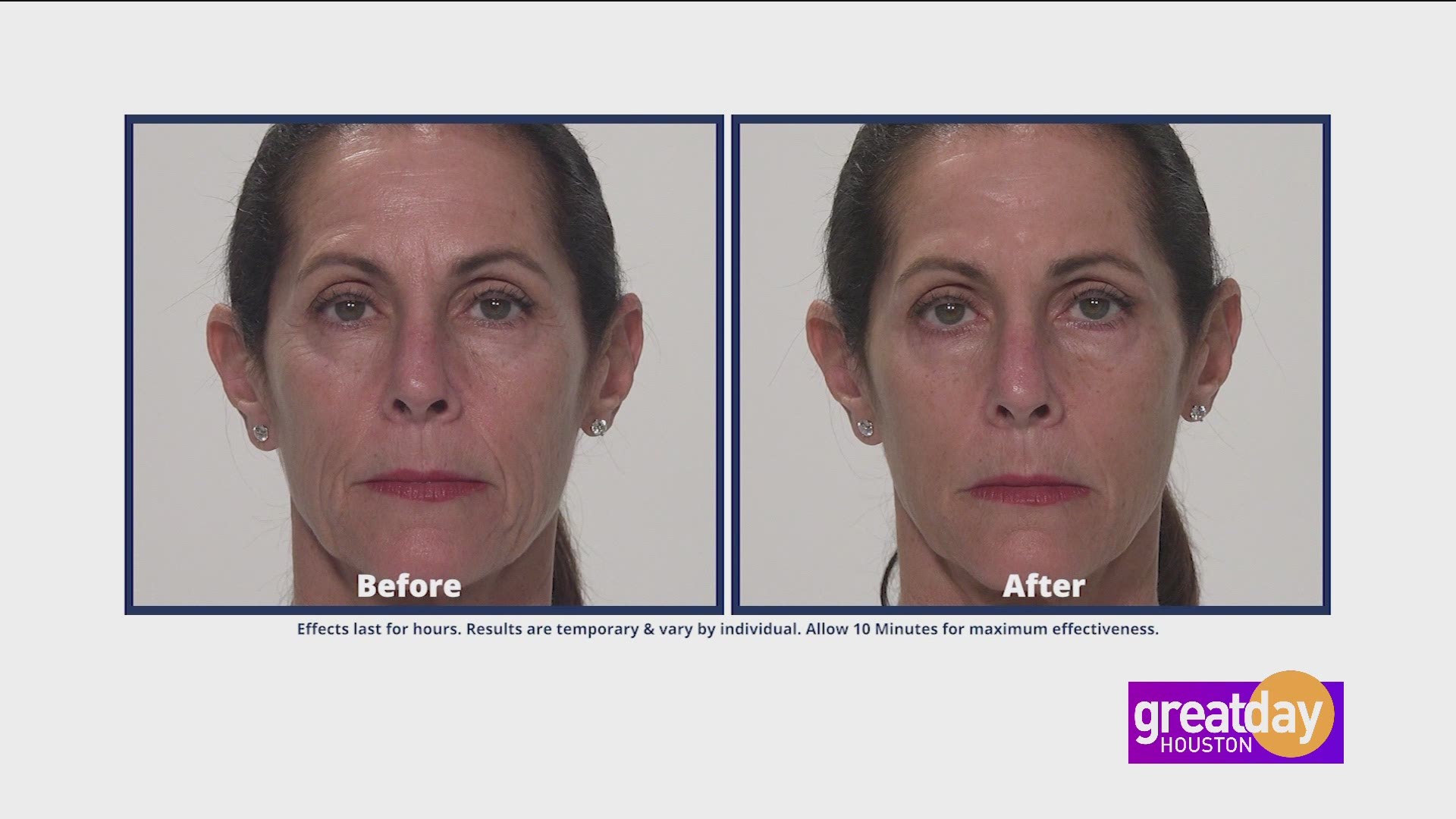 plexaderm for wrinkles