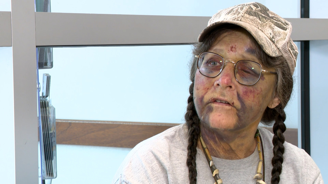 Woman suffers brutal attack during solo protest on I-45 overpass