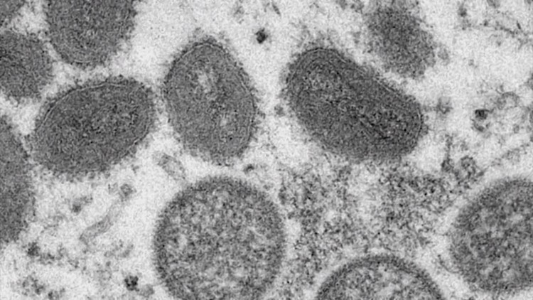VERIFY: Fact-checking common claims about the monkeypox virus