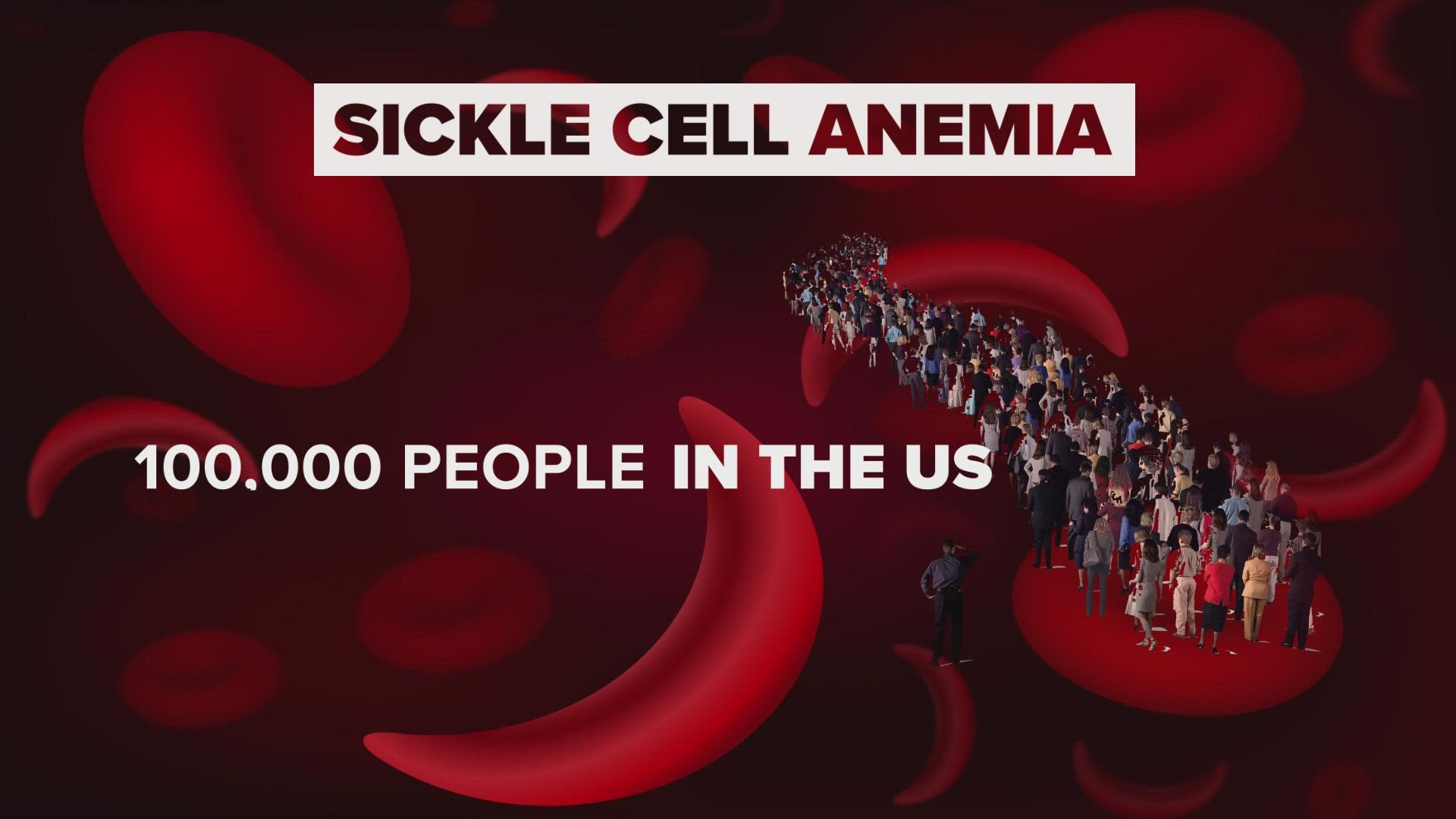 SCD is the most common inherited blood disorder in the U.S. and affects approximately 100,000 Americans.